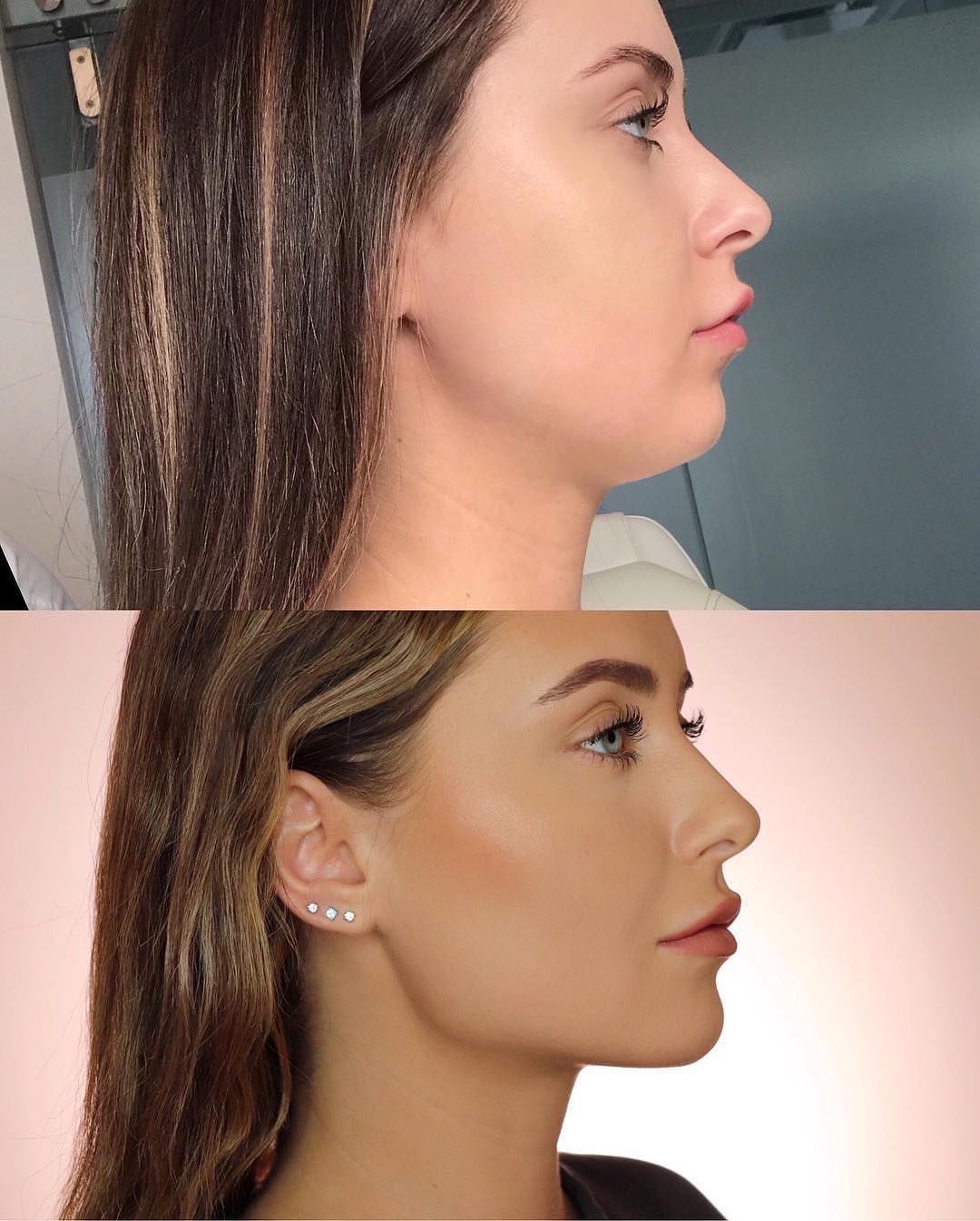 4-in-1 Face Sculptor